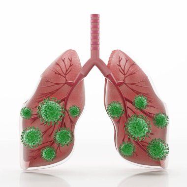 İnsan ciğerlerinin etrafındaki yeşil virüsler. 3B illüstrasyon.