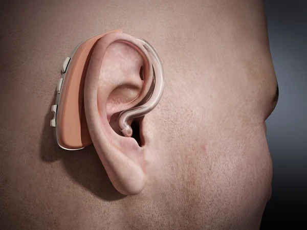 Ear aid on ear — Stock Photo, Image