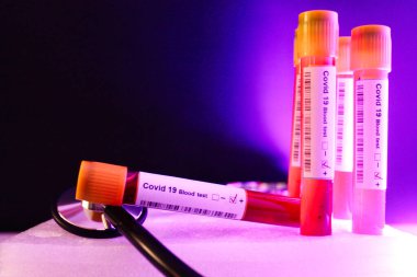 covid 19 kan testi pozitif virüs bulaşıcı.