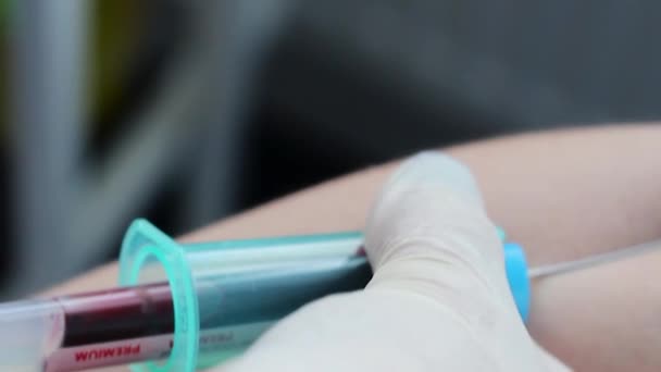 O sangue foi tirado em um tubo de teste. Testes de Sangue no Laboratório Médico . — Vídeo de Stock