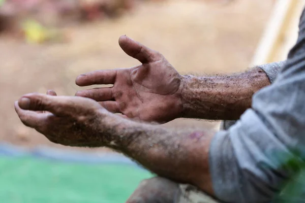 Mãos Sujas Mineiro Trabalhador Jardineiro Lenhador São Palmas Milho Abrasões — Fotografia de Stock