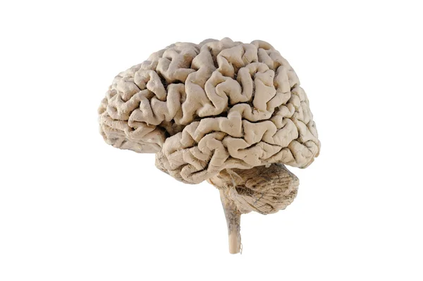 Medial view of human brain — Stock Photo, Image