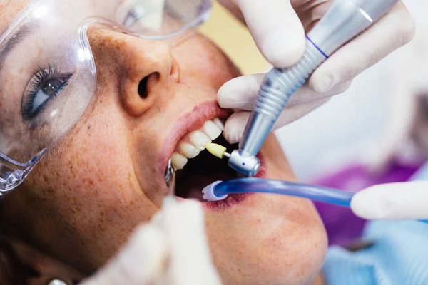 Image from above of a dentist treating a patient\'s teeth along with his assistant. The dentist\'s hands working on the care of the teeth.