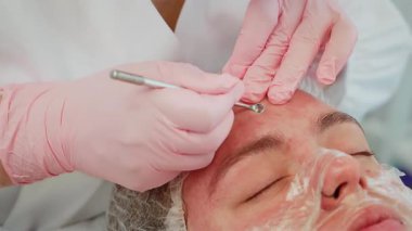 Barışçıl bir ifadeyle tedavi masasında uzanan kadın kozmetoloji müşterisi eldivenli güzellik uzmanının cilt temizleme prosedüründen geçiyor. Profesyonel kozmetoloji seansı sırasında sivilceleri alınarak rahatlayan bir kadın. Cilt bakımı yapan kadın