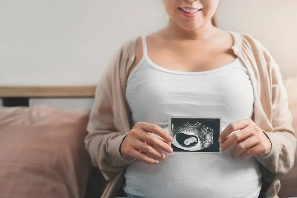 Mujer Embarazada Asiática Sosteniendo Imagen Ecografía Expectativa Niño Cuidado Prenatal — Foto de Stock