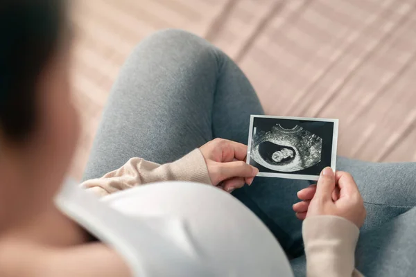 Mujer Embarazada Asiática Sosteniendo Imagen Ecografía Expectativa Niño Cuidado Prenatal — Foto de Stock