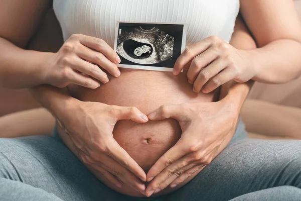 アジアの妊婦と夫が手を携えて超音波スキャン画像を保持し 彼女の腹に手の心臓ジェスチャーを作る 子供と女性の妊娠の概念への期待 — ストック写真
