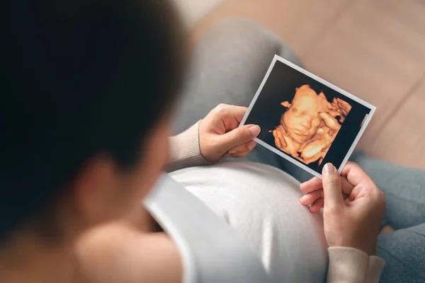 Asiática Embarazada Sosteniendo Ultrasonido Imagen Exploración Expectativa Niño Maternidad Prenatal — Foto de Stock