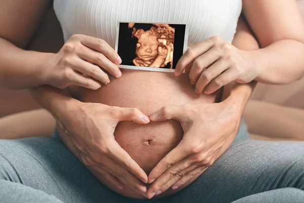 Mujer Embarazada Asiática Esposo Sosteniendo Mano Juntos Sosteniendo Ultrasonido Imagen — Foto de Stock