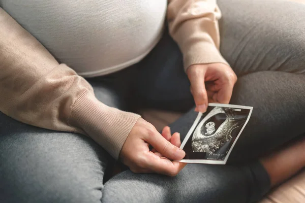 Mujer Embarazada Asiática Sosteniendo Imagen Ecografía Expectativa Niño Cuidado Prenatal — Foto de Stock