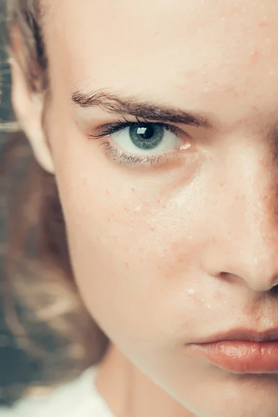 Vrouw met sproeten op gezicht — Stockfoto