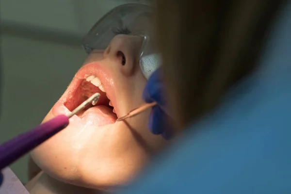 Close-up portret van een vrouwelijke patiënt bij de tandarts in de kliniek. Mooi meisje in een tandartsstoel op het examen bij de tandarts. Resultaat van het bleken van tanden. Tandvulling ultraviolette lamp. — Stockfoto