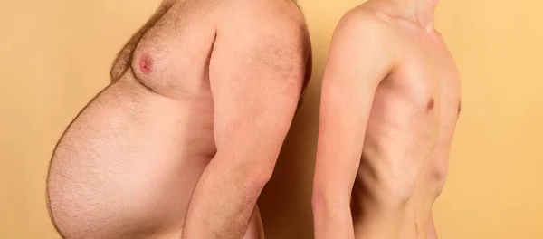 Homem antes e depois da perda de peso. Estilo de vida pouco saudável. — Fotografia de Stock