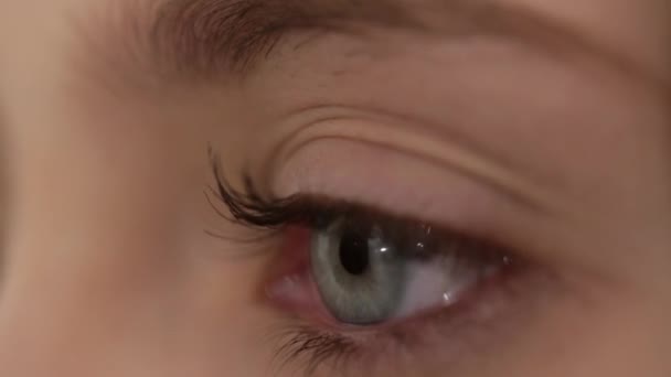 Катаракта. Женский глаз крупным планом. Концепция офтальмологии. Синяя радужная оболочка век. — стоковое видео