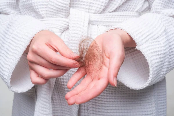 Problema perdita dei capelli in mano, isolato. Danneggiato capelli malsani in primo piano mano. — Foto Stock