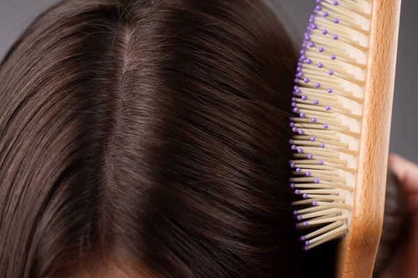 Cierra el pelo problemático. Macro cuidado del cabello y concepto de pérdida de cabello. —  Fotos de Stock