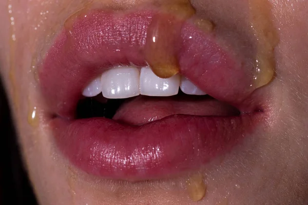 Mézes szájjal, cukormaszkkal. Szájsebész. Ajkak gyönyörű fiatal nő borított cukor, Closeup. — Stock Fotó