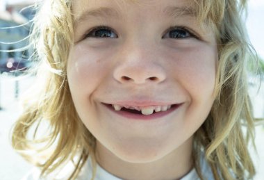 Dişleri dökülmüş gülümseyen bir çocuk. Diş aralığı gösteren eğlenceli bir çocuk. Bebek dişlerinin kapanışı. Çocuğun süt dişleri dökülüyor. Çocuk ağzı ve yeni dişler. Dişsiz gülüşlü çocuk. Çocuklar dişlerini kaybetti. Çocuk dişleri