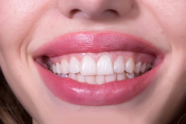 Tandheelkundige vrouwelijke glimlach — Stockfoto
