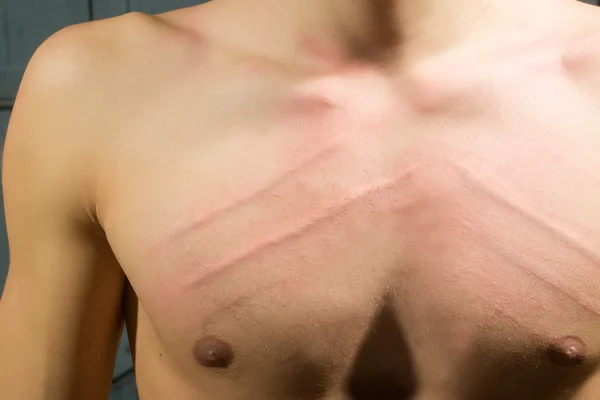 Male chest with scores — Stock Photo, Image