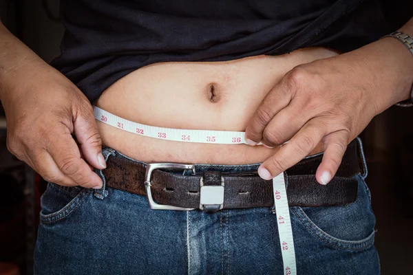 Hombre gordo y cinta métrica — Foto de Stock