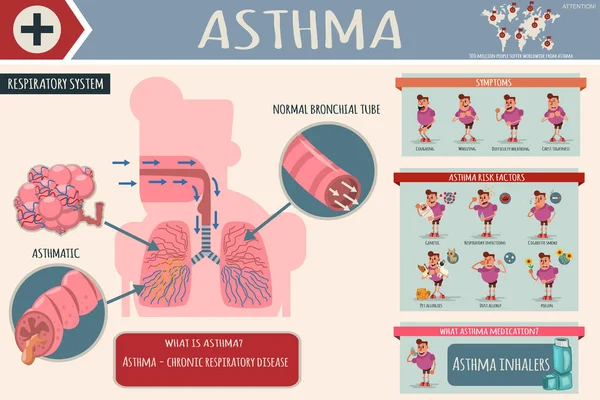 Astım belirtileri, risk faktörleri ve ilaçlar. Sağlıklı ve hasta akciğerli insan solunum sisteminin tıbbi karikatür bilgileri. Hastalıklı bir adamın karakterinin vektör çizimi.