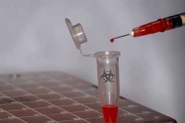 Coronavirus kan örneği şırıngadan laboratuvar şişesine aktarılıyor.