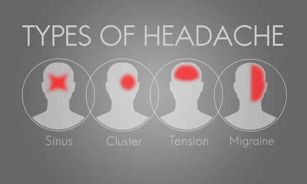 Baş ağrısı belirti migren — Stok fotoğraf