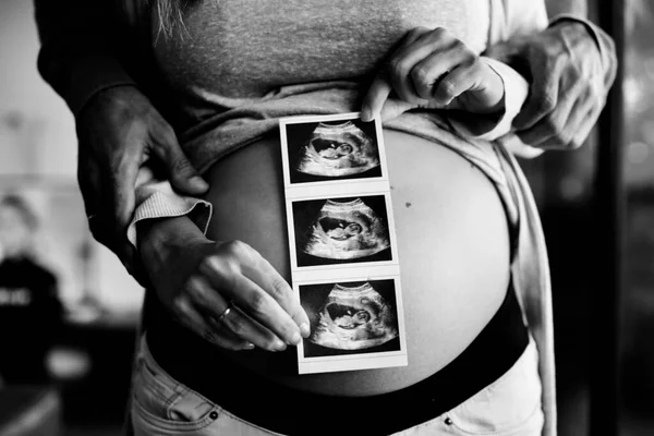 Mujer Embarazada Foto Del Bebé — Foto de Stock