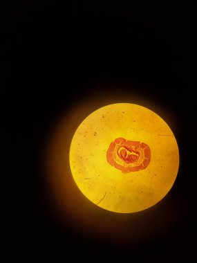 Bir solucanın enine kesit. Mikroskopta bir solucan iç yapısı.