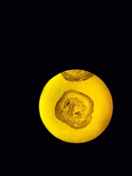 Sección Transversal Una Lombriz Estructura Interna Una Lombriz Microscopio —  Fotos de Stock