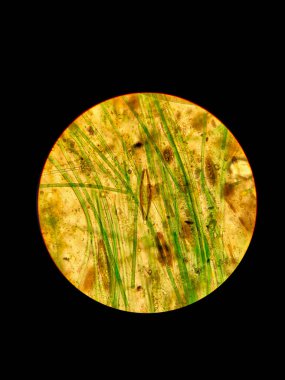 Dirty water sample under a microscope.Sample of dirty water through a microscope. Blue-green and diatoms. Dominated by the navicula and the oscillator