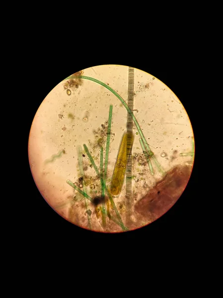 脏水样本 发现绿色和硅藻 振荡和羽毛虫 — 图库照片