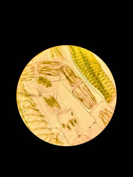 Amostra Água Suja Sob Microscópio Zignema Algas Spirogyra — Fotografia de Stock