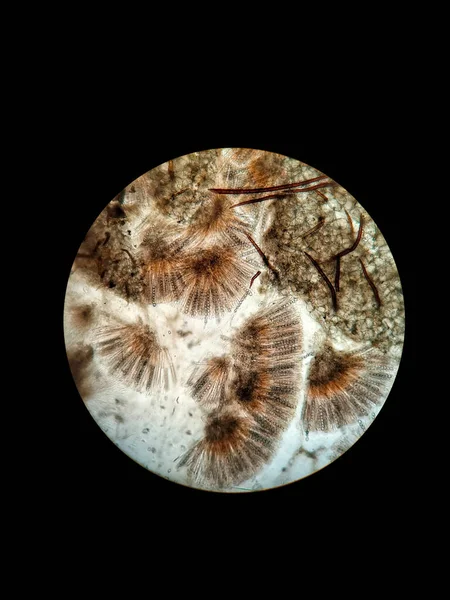 현미경을 포자가 버섯의 슬라이스입니다 Mycological Drug 입니다 Scutellinia Scutellata — 스톡 사진