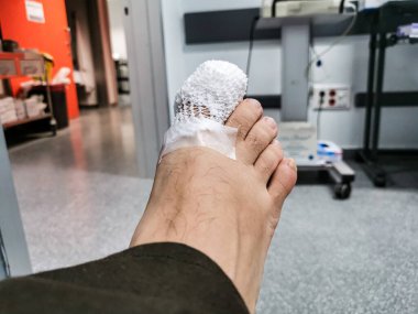 Çıplak ayakla yatay çekim, onu korumak için ilk ayak parmağı bandajlı, ağ şeklinde sargı bezi ve örgü ile arka planda odak dışı bir hastane koridorlarında..