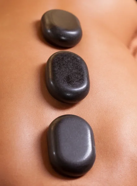 Part of woman back with black stones — Stock Photo, Image