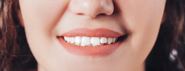 Belo sorriso branco de mulher. Publicidade para higiene oral e odontologia. Banner longo — Fotografia de Stock