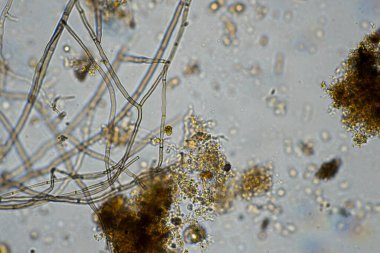 mikroorganizmalar ve toprak biyolojisi, mikroskop altında nematodlar ve mantarlar. Çiftlikteki bir toprak ve gübre örneğinde