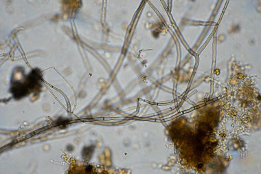 mikroorganizmalar ve toprak biyolojisi, mikroskop altında nematodlar ve mantarlar. Çiftlikteki bir toprak ve gübre örneğinde