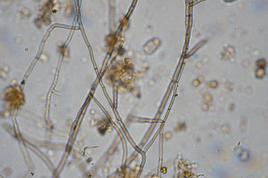 mikroorganizmalar ve toprak biyolojisi, mikroskop altında nematodlar ve mantarlar. Çiftlikteki bir toprak ve gübre örneğinde