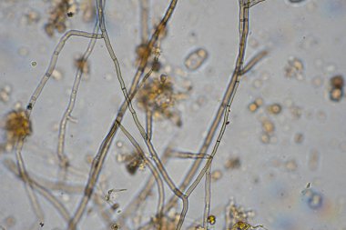 mikroorganizmalar ve toprak biyolojisi, mikroskop altında nematodlar ve mantarlar. Çiftlikteki bir toprak ve gübre örneğinde