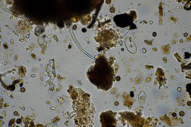 mikroorganizmalar ve toprak biyolojisi, mikroskop altında nematodlar ve mantarlar. Çiftlikteki bir toprak ve gübre örneğinde