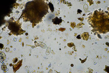 mikroorganizmalar ve toprak biyolojisi, mikroskop altında nematodlar ve mantarlar. Çiftlikteki bir toprak ve gübre örneğinde