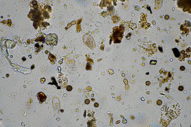 mikroorganizmalar ve toprak biyolojisi, mikroskop altında nematodlar ve mantarlar. Çiftlikteki bir toprak ve gübre örneğinde
