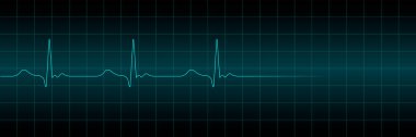 Karanlık bir arkaplanda vektör kardiyogram ya da nabız. Kalp kardiyogram elektrokardiyogramı atar. Vektör illüstrasyonu