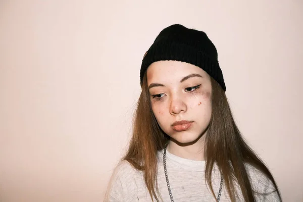 Adolescente Vítima Violência Doméstica Rua Abuso Fundo Brilhante — Fotografia de Stock