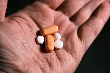 Beyaz ve turuncu antiretroviral tedavi hapları eldeki HIV tedavisi için. Dolutegravir, Abacavir, Lamivudine. Dünya AIDS Günü konsepti. Sağlık ve ilaç servisi. Haplar ve ilaçlar.