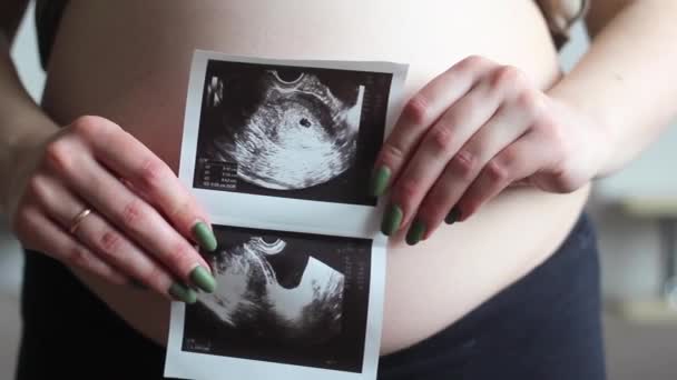 Hamile Kadın Bebeğinin Ultrason Taramasıyla Ayakta Duruyor Yakın Plan Hamile — Stok video