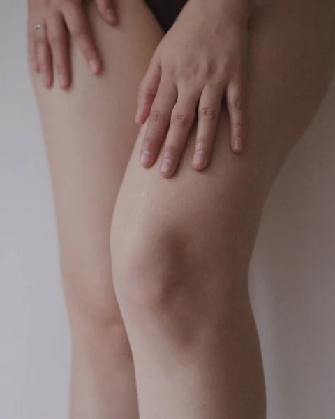 Frau Mit Händen Auf Den Knien — Stockfoto